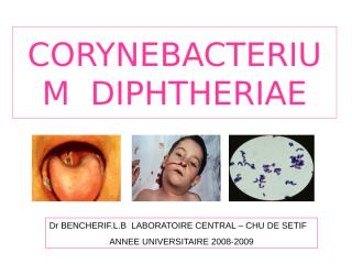 corynebacterium  diphtheriae2 bacterio.ppt